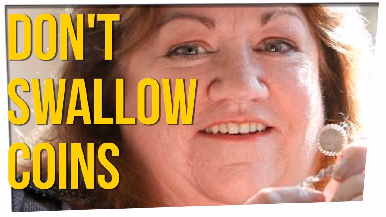 What is the treatment for coin swallowing?